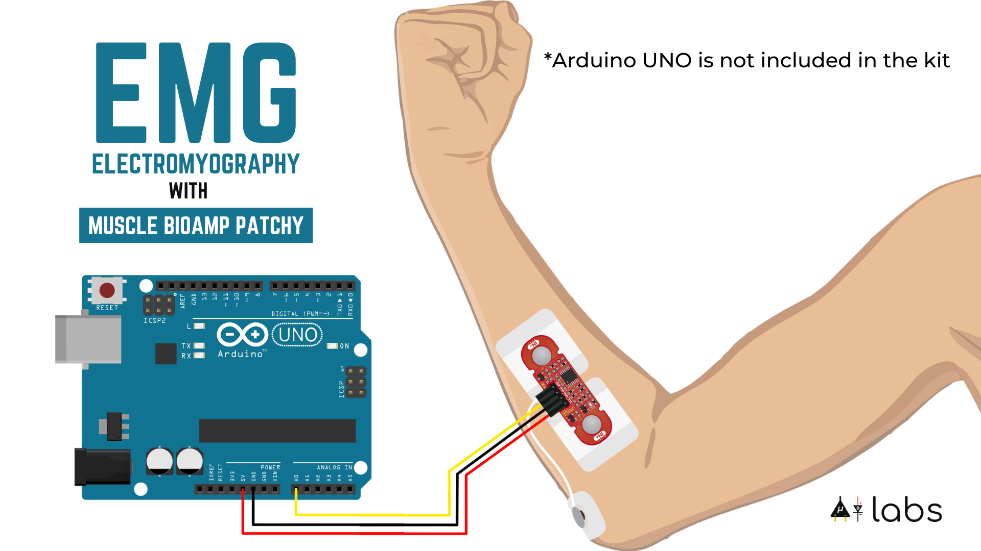 Bioamp Sensor Muscle BioAmp Patchy (Wearable Muscle Sensor) from Upside Down Labs on ...